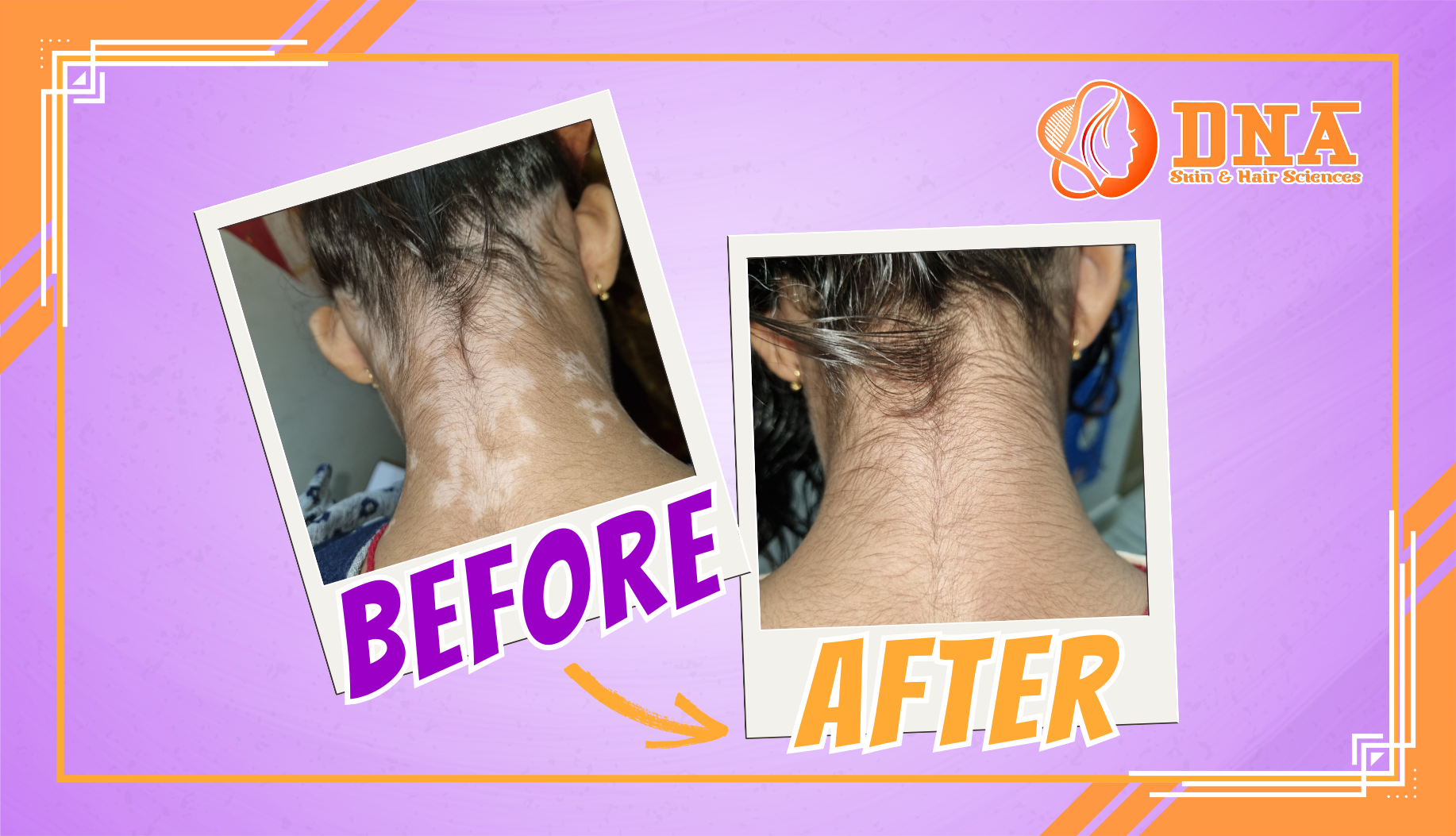 DNA Skin and Hair Sciences Patient Before and After Result
