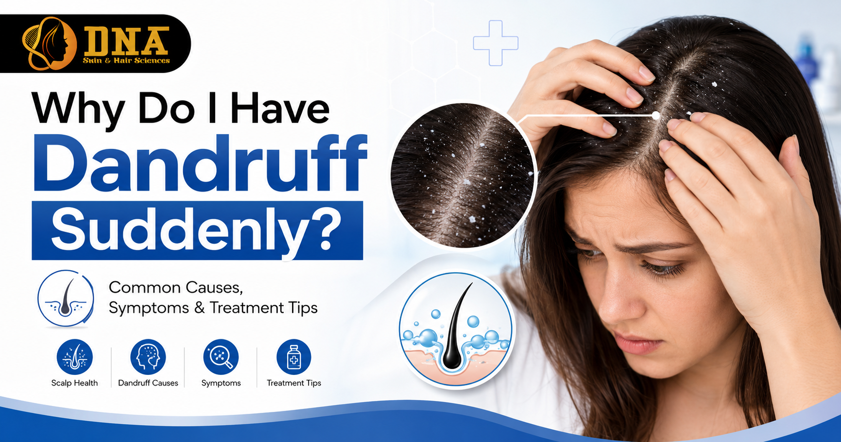 Why Do I Have Dandruff Suddenly?